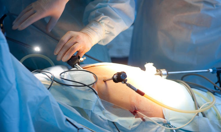 Gyane laparoscopic surgery in Solapur | laparoscopic doctor in Solapur