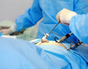 Gyane laparoscopic surgery in Solapur | laparoscopic doctor in Solapur
